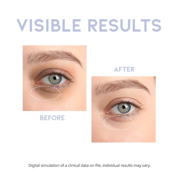 OOTD - Intensive Eye Serum - 30g